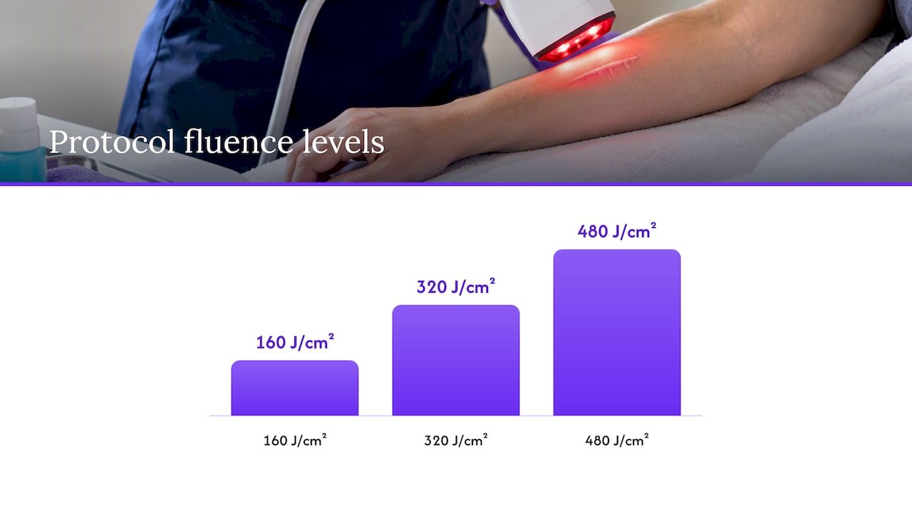 Trial light doses and treatment schedule